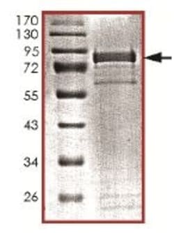 Abcam Recombinant Human CDKL5 protein, 20UG, Quantity: Each of 1