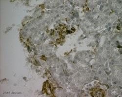 Abcam Rabbit polyclonal to Desmin - Cytoskeleton Marker, Quantity: Each