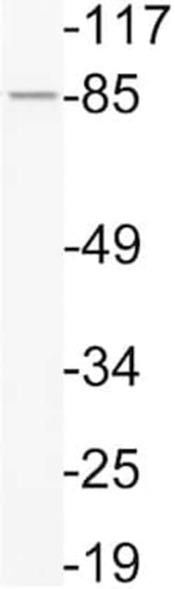 Abcam Rabbit polyclonal to PI 3 Kinase p85 beta (phospho Y464), Quantity: