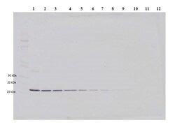 Abcam Rabbit polyclonal to IL-1 beta, Quantity: Each of 1