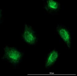 Abcam Rabbit polyclonal to Smad2 (phospho S467), Quantity: Each of 1