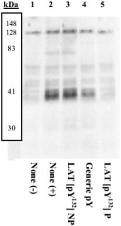 Abcam Rabbit polyclonal to LAT (phospho Y132), Quantity: Each of 1