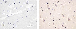 Abcam Rabbit polyclonal to PDGFR alpha (phospho Y754), Quantity: Each of