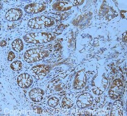 Abcam Mouse monoclonal [6F12BE10] to Calnexin, Quantity: Each of 1