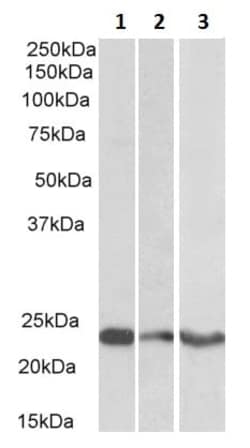 Abcam Goat polyclonal to TREM2 - C-terminal, Quantity: Each of 1