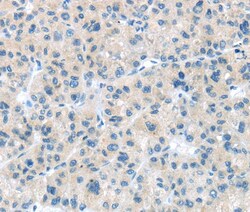 Abcam Rabbit polyclonal to CD63 - Late Endosome Marker, Quantity: Each