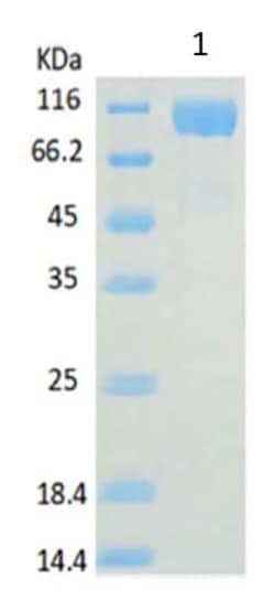 Abcam Recombinant Human ACE2 protein, 10UG, Quantity: Each of 1