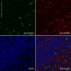 Abcam Alexa Fluor 488 Mouse monoclonal [KP1] to CD68, Quantity: Each of
