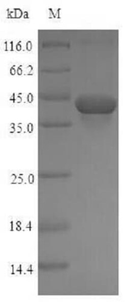 Abcam Recombinant Rat TGF beta 1 protein (Tagged), 100UG, Quantity: Each