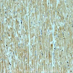 Abcam Rabbit polyclonal to PDGF B, Quantity: Each of 1
