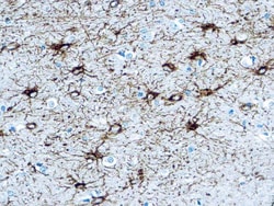 Diagnostic Biosystems GFAP CONC. POLYCLONAL AB 1ML Glial Fibrillary Acidic