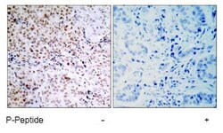 Abcam Rabbit polyclonal to Rb (phospho S795), Quantity: Each of 1