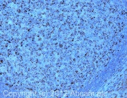 Abcam Mouse monoclonal [60.11] to GC1q R, Quantity: Each of 1