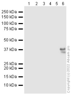 Abcam Rabbit polyclonal to Histone H1.5 - ChIP Grade, Quantity: Each of