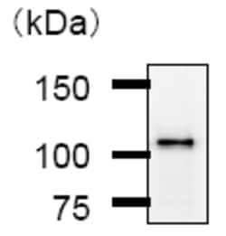 Abcam Anti-CHD1L antibody [2170C3a], Quantity: Each of 1