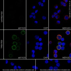 Abcam Rabbit monoclonal [EP1406Y] to PLCG 2 (phospho Y759), Quantity: Each