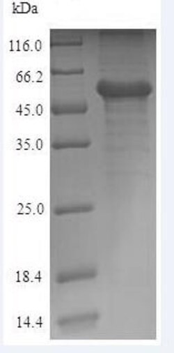 Abcam Recombinant Human Calreticulin protein (His tag), 100UG, Quantity: