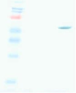 Abcam Mouse monoclonal [2D7] to Measles nucleoprotein, Quantity: Each of