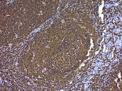 Abcam Antigen Retrieval Buffer (100X Citrate Buffer), Quantity: Each of