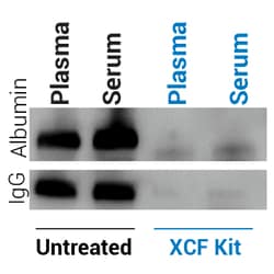 System Biosciences LLC&nbsp;XCF EXOSOMAL DNA ISOLATION KITXCF Exosomal DNA Isolation Kit = 20 Reactions