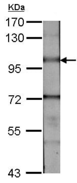 Abcam Rabbit polyclonal to BMPR2, Quantity: Each of 1