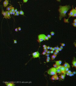 Abcam Rabbit polyclonal to CaMKII beta, Quantity: Each of 1