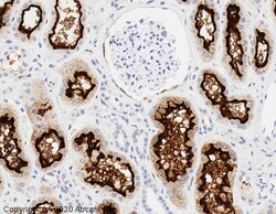 Abcam Mouse monoclonal [MM0073-11A31] to ACE2, Quantity: Each of 1