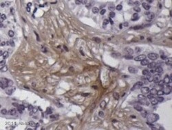 Abcam Rabbit polyclonal to Cannabinoid Receptor I, Quantity: Each of 1