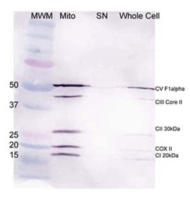 Abcam Mitochondria Isolation Kit for Cultured Cells (with Dounce