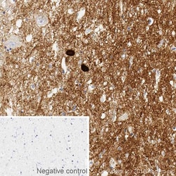 Abcam Mouse monoclonal [syn211] to Alpha-synuclein, Quantity: Each of 1