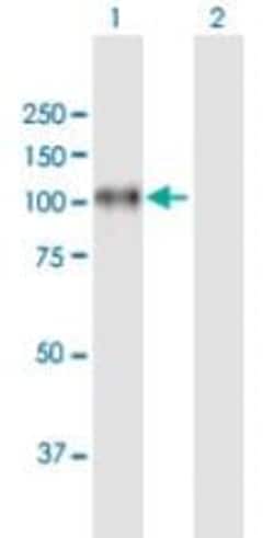 Abcam Mouse polyclonal to Integrin beta 8, Quantity: Each of 1