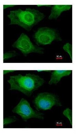 Abcam Rabbit polyclonal to AKR1B10, Quantity: Each of 1