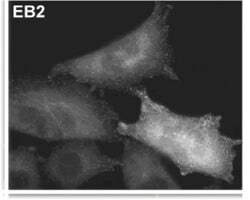 Abcam Anti-EB2 antibody [KT52], Quantity: Each of 1