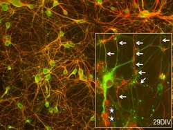 Lonza Walkersville Rat Brain Cortex Neurons, Quantity: Each of 1