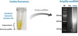System Biosciences LLC&nbsp;ExoQuick Exosome Isolation and RNA Purification Kit (for Serum & Plasma)ExoQuick Exosome Isolation and RNA Purification kit (for Serum & Plasma) = 20 preps