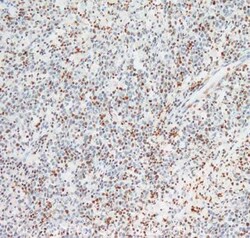 Abcam Rabbit polyclonal to Chk2 (phospho T68), Quantity: Each of 1