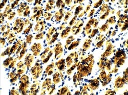 Abcam Rabbit polyclonal to Myocilin, Quantity: Each of 1