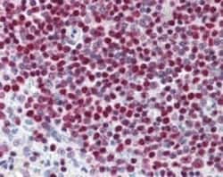 Abcam Mouse monoclonal [A6.4.12] to PARP1, Quantity: Each of 1