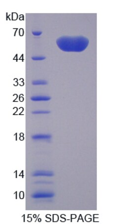 Aviva Systems Biology Corp TREM2 Recombinant Protein (OPCD07713) | 50ug,