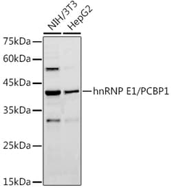 ABclonal Technology hnRNP E1/PCBP1 Rabbit pAb, Quantity: Each of 1