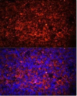 Abcam Rabbit polyclonal to TLR8, Quantity: Each of 1