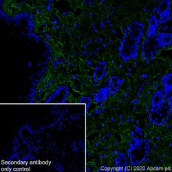 Abcam Rabbit monoclonal [EPR24331-53] to Collagen I, Quantity: Each of
