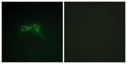 Abcam Rabbit polyclonal to Neurofibromin, Quantity: Each of 1