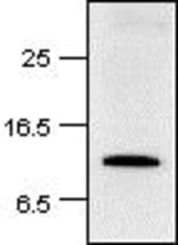 Abcam Rabbit polyclonal to Histone H2A, Quantity: Each of 1