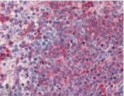 Abcam Rabbit polyclonal to TNF Receptor I, Quantity: Each of 1