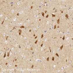 Abcam Mouse monoclonal [K28/43] to PSD95 - Synaptic Marker, Quantity: Each