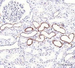 Abcam Goat Anti-Mouse IgG+IgM H&L (HRP) preadsorbed, Quantity: Each of