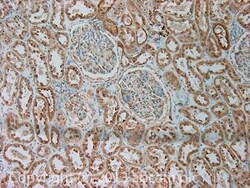 Abcam Rabbit polyclonal to Leptin Receptor, Quantity: Each of 1