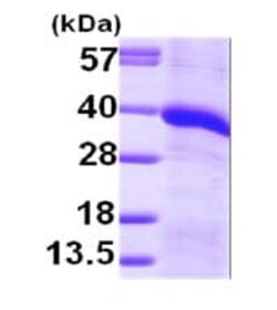 Abcam Recombinant Human Monoacylglycerol Lipase/MGL protein, 50UG, Quantity: