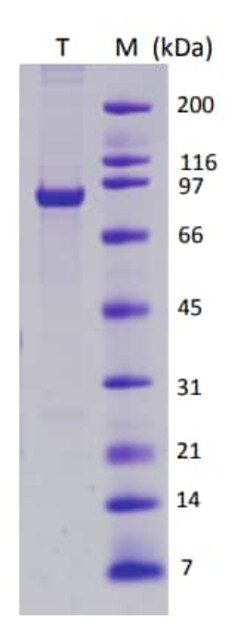Abcam Recombinant Simian Virus 40 SV40 Large T Antigen protein, Quantity: